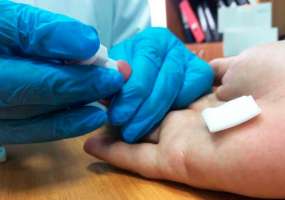 Российские ученые научились быстро распознавать рак - НТР 24