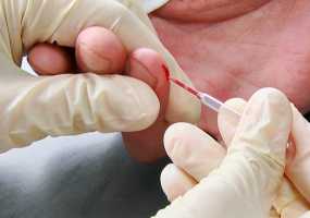 Онкобольных на протяжении почти 10 лет заражали гепатитом С - НТР 24