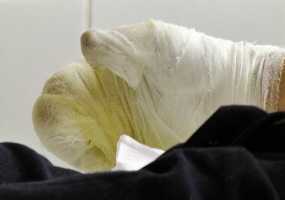 СМИ: трое пострадавших на пожаре на заводе в Нижнекамске обгорели практически полностью - НТР 24