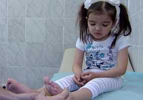 Русфонд: 5-летней Азалии с левосторонней косолапостью требуется дорогостоящее лечение