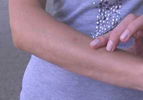 В одежде этого цвета людей не кусают комары - НТР 24