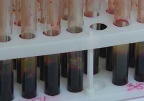 В Нижнекамске работает НКО, помогающая ВИЧ-инфицированным - НТР 24