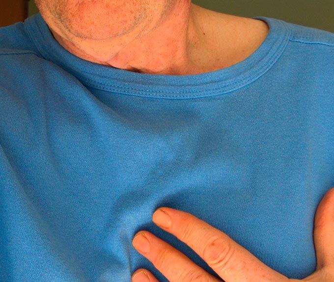 Неожиданный симптом приближающегося инфаркта назвали немецкие кардиологи