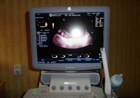 Гинеколог в кабинете УЗИ снимал на камеру своих пациенток - НТР 24