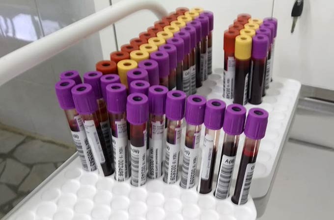 Положительные тесты на коронавирус 21 татарстанца находятся на подтверждении