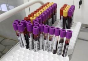 Положительные тесты на коронавирус 21 татарстанца находятся на подтверждении