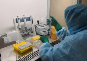 Рекордное количество: 3388 новых случаев коронавируса зарегистрировано в России