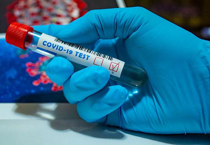 В Татарстане 18 мая выявлено 80 новых случаев коронавируса