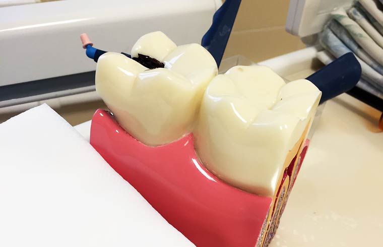 «Я видела, в каких мучениях умирают люди»: стоматолог напомнила о смертельной опасности кариеса