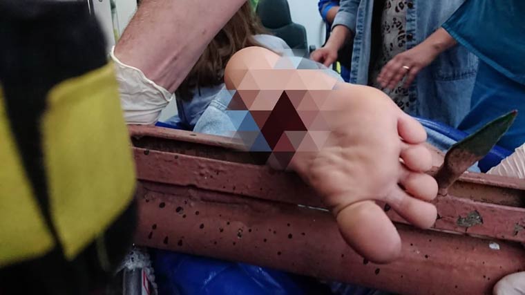 В Татарстане девочка упала на забор и проткнула ногу