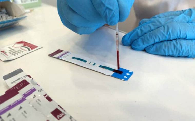 Инфекционист рассказала, как чувствует себя сейчас первый в Нижнекамске пациент с ВИЧ