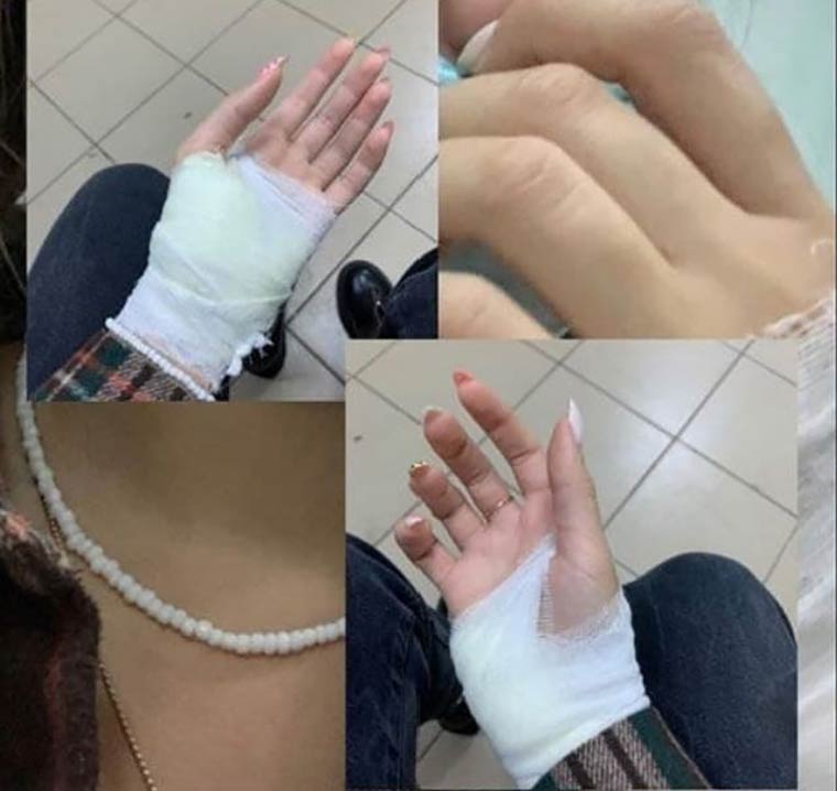 Руки девушки после операции