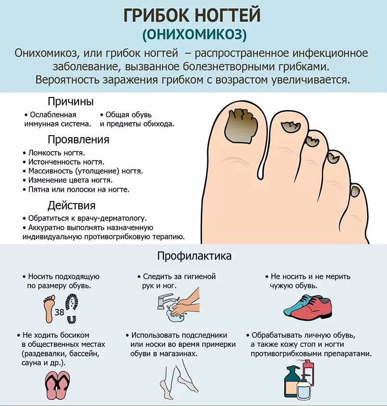 Народные средства при грибке ногтя на ногах