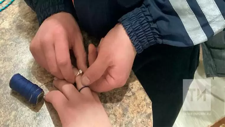 В Татарстане спасатели прибегли к лайфхаку, чтобы снять кольцо с пальца женщины