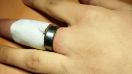В Татарстане ребёнок надел на палец кольцо от подшипника, снимать его приехали спасатели