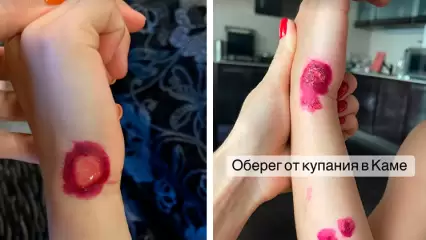 Соцсети: в Татарстане у ребенка после купания в Каме появились волдыри - НТР 24