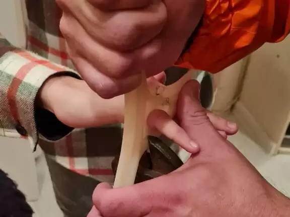 В Татарстане спасатели помогли подростку, у которого палец застрял в вешалке
