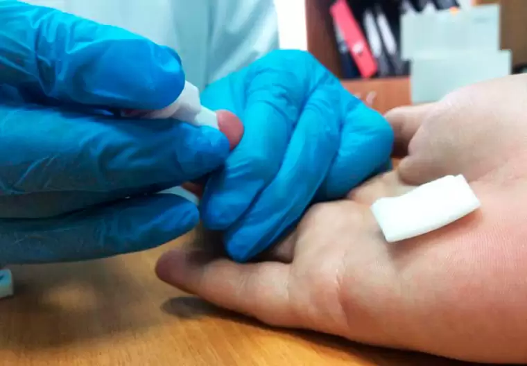 В Нижнекамске пройдет бесплатное экспресс-тестирование на ВИЧ и гепатит С