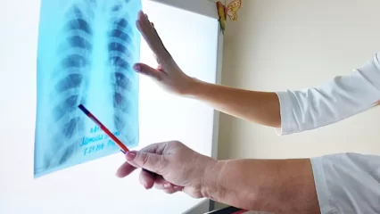 В Нижнекамске и районе за год туберкулёзом заболели 57 человек