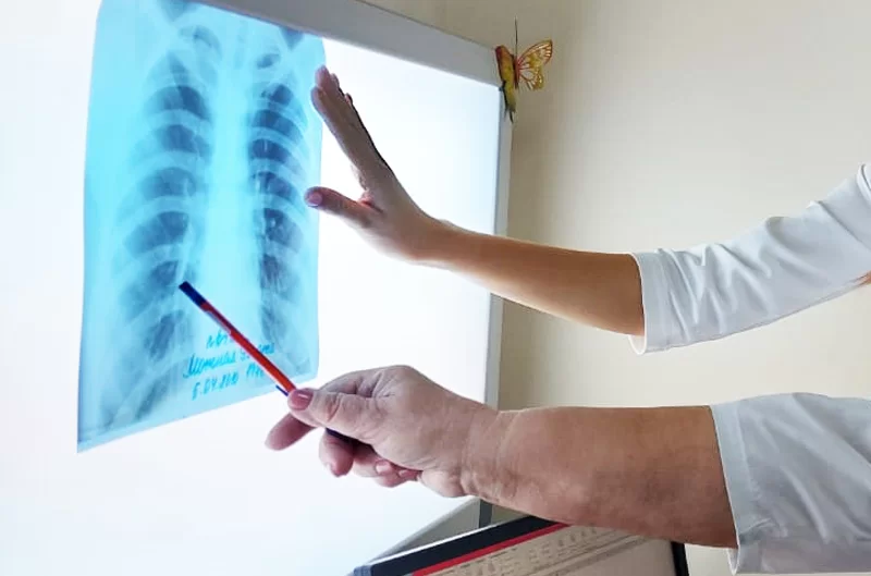 В Нижнекамске и районе за год туберкулёзом заболели 57 человек