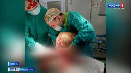 В Татарстане врачи РКБ за раз удалили женщине 20-килограммовую кисту, грыжу и камни