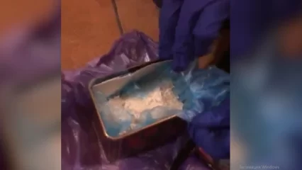 В Нижнекамске задержали закладчицу с 300 граммами наркотиков - НТР 24