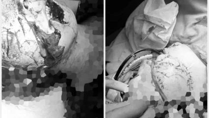 В Татарстане собака разодрала лицо беременной женщине