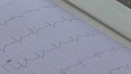 Нижнекамский кардиолог назвала особенность женщин, которая защищает их от инфаркта - НТР 24