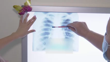 В Татарстане растет количество заболевших туберкулезом - НТР 24