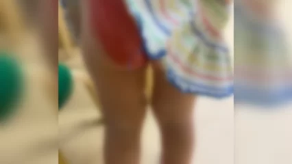 В Нижнекамске ребенок получил ожог в детском саду, прокуратура проводит проверку - НТР 24