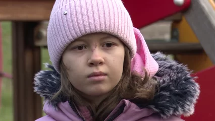 В нижнекамском поселке бойцовская собака напала на ребенка - НТР 24