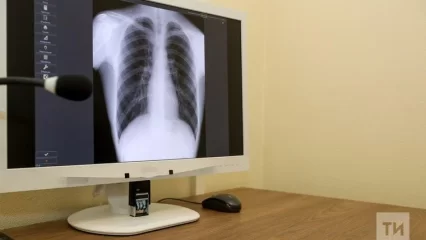 Врачи рассказали, как спастись от пневмонии  - НТР 24