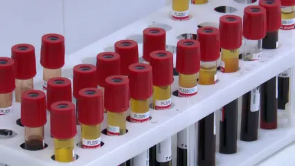 40 работников «Нэфис косметикс» заразились сальмонеллезом - НТР 24