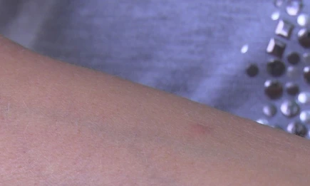 Терапевт рассказала, кого чаще кусают комары - НТР 24