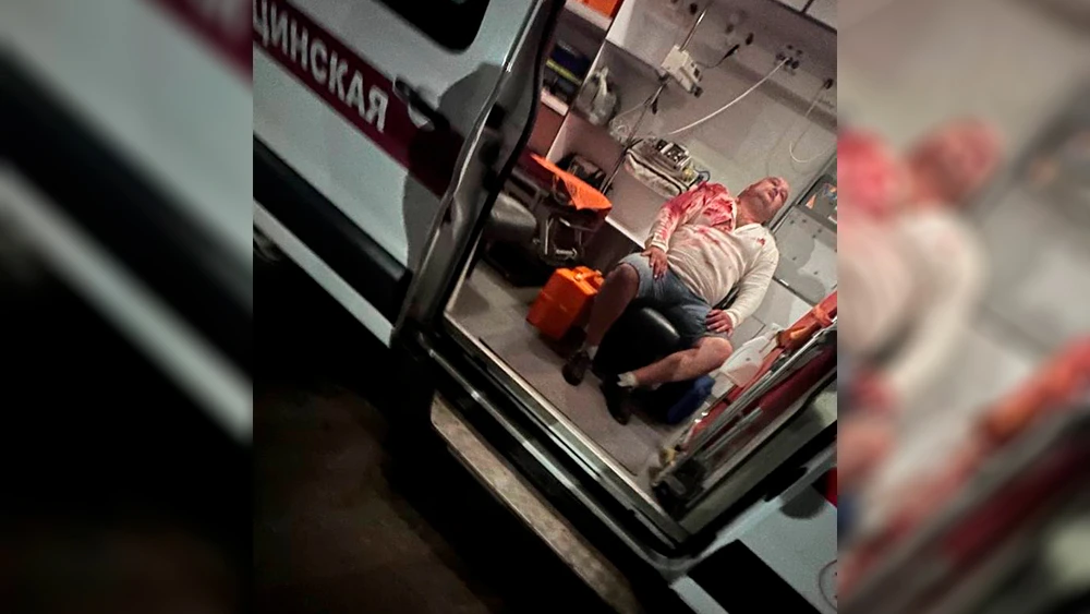 раненый медведем концертный директор Вадим Фатхинуров