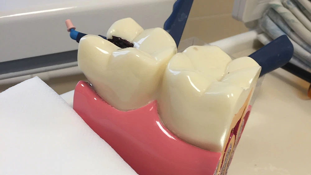 Макет зубов