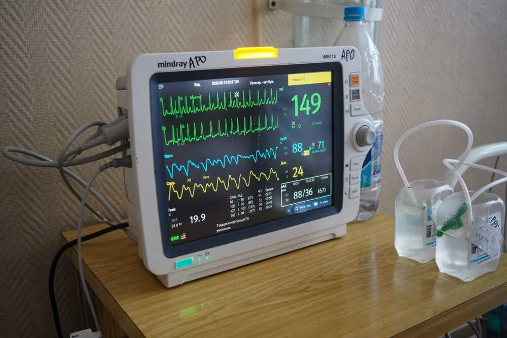 Монитор пациента в больнице