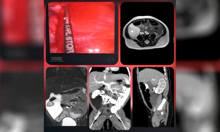 В Татарстане провели уникальную операцию новорожденному с редкой аномалией - НТР 24