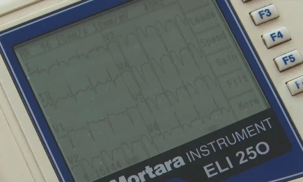 Депутаты Госдумы предлагают признать ожирение социально значимым заболеванием в России - НТР 24
