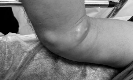 В Татарстане врачи спасли от суицида иностранца. Пациент говорил только по-испански. Как медики нашли выход? - НТР 24