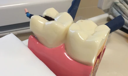 Стоматолог назвала главных врагов зубной эмали - НТР 24