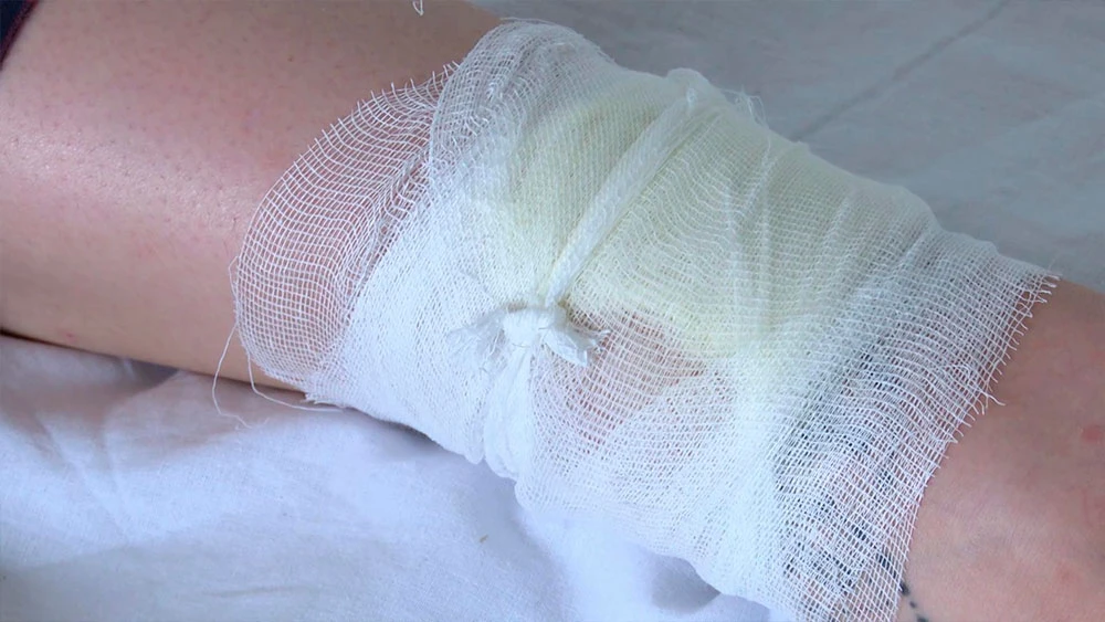 Перебинтованная нога