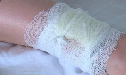 Химик предупредил об опасности йода и зеленки для ран - НТР 24