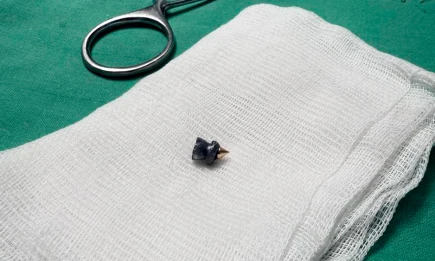 В Татарстане врачи спасли 25-летнего мужчину, случайно выстрелившего себе в шею - НТР 24