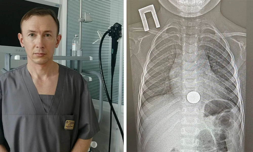 Детский хирург, врач-эндоскопист Игорь Шогоров рентген
