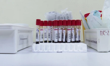 6 правил: нижнекамские врачи рассказали, как защититься от ВИЧ - НТР 24