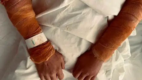 В Татарстане двое мужчин получили ожоги в общественной бане - телеканал НТР 24