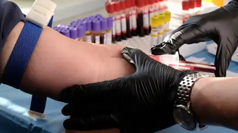 С 26 января по 1 февраля в России проходит Неделя профилактики неинфекционных заболеваний - телеканал НТР 24