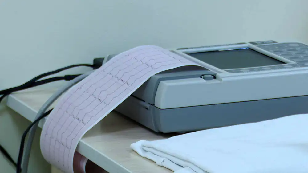 электрокардиограмма