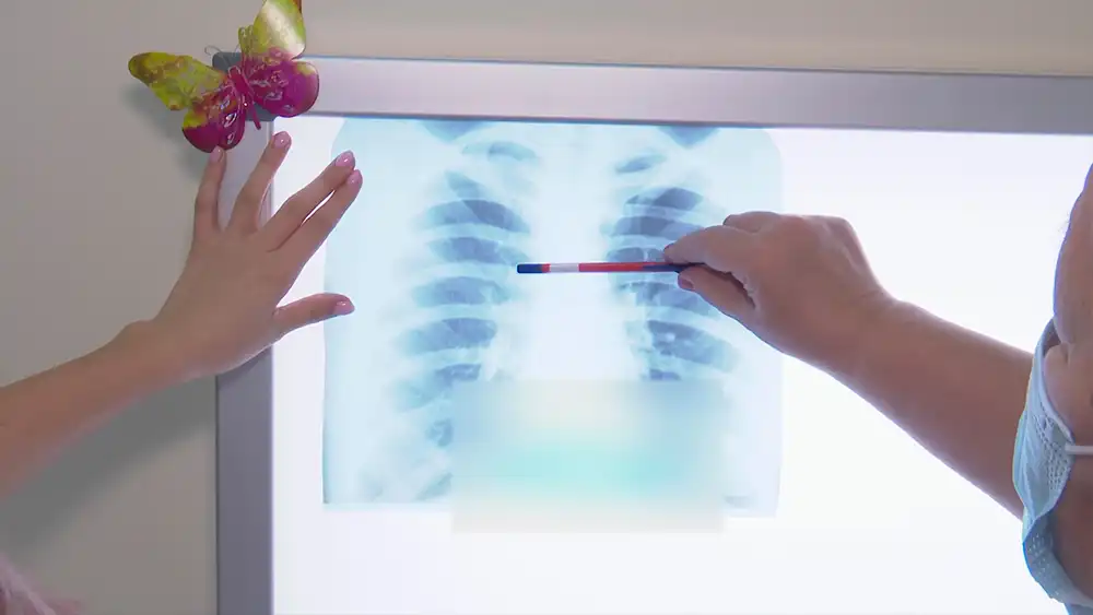 Снимок лёгких